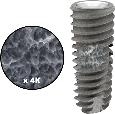 Zobu Implanti - virsma